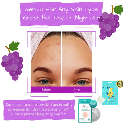 Vitamin c hyaluronic acid serum